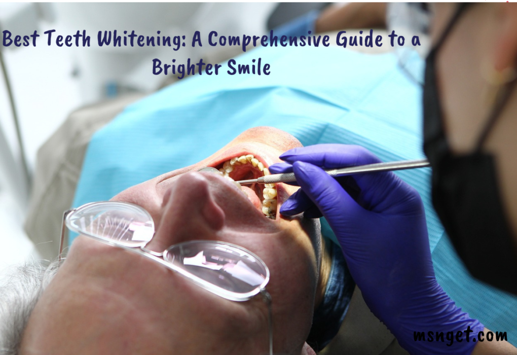 Best Teeth Whitening: A Comprehensive Guide to a Brighter Smile