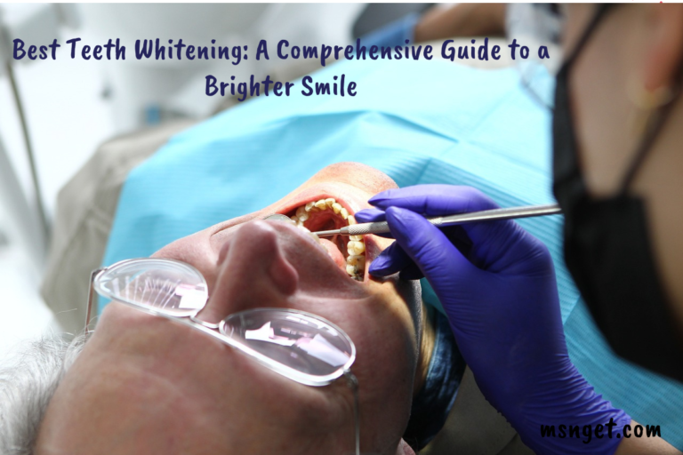 Best Teeth Whitening: A Comprehensive Guide to a Brighter Smile